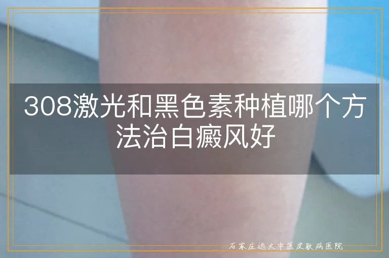 308激光和黑色素种植哪个方法治白癜风好