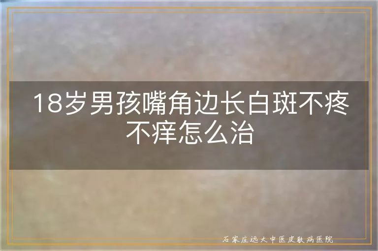 18岁男孩嘴角边长白斑不疼不痒怎么治