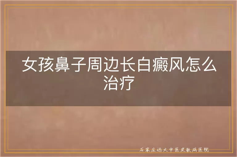 女孩鼻子周边长白癜风怎么治疗