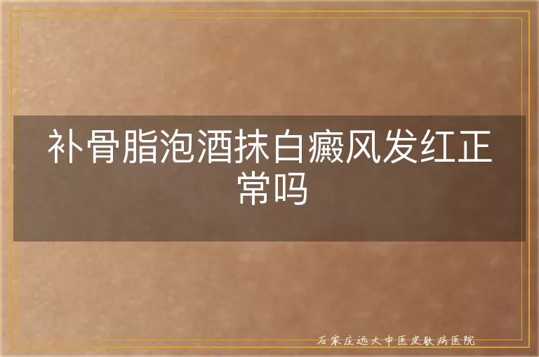 补骨脂泡酒抹白癜风发红正常吗