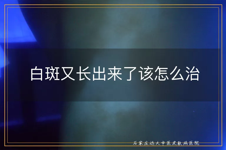 白斑又长出来了该怎么治