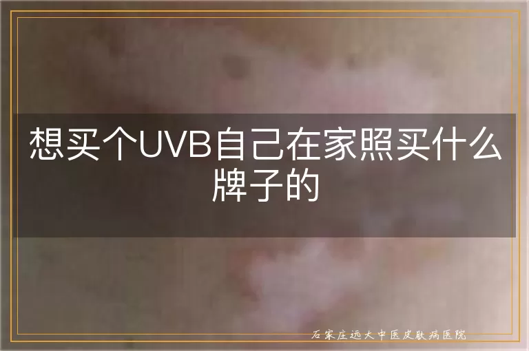 想买个UVB自己在家照买什么牌子的