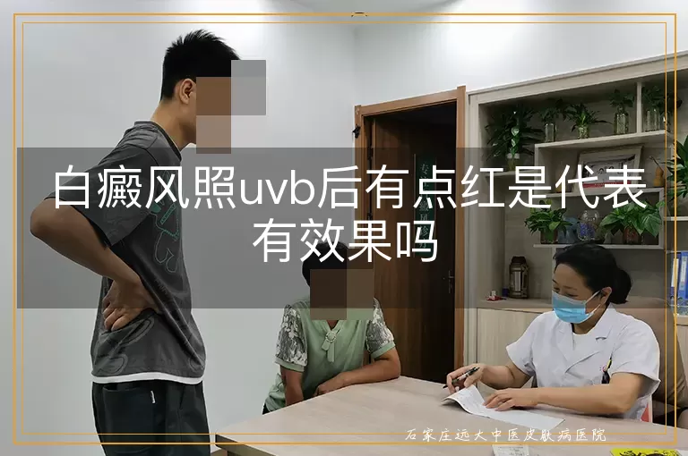 白癜风照uvb后有点红是代表有效果吗