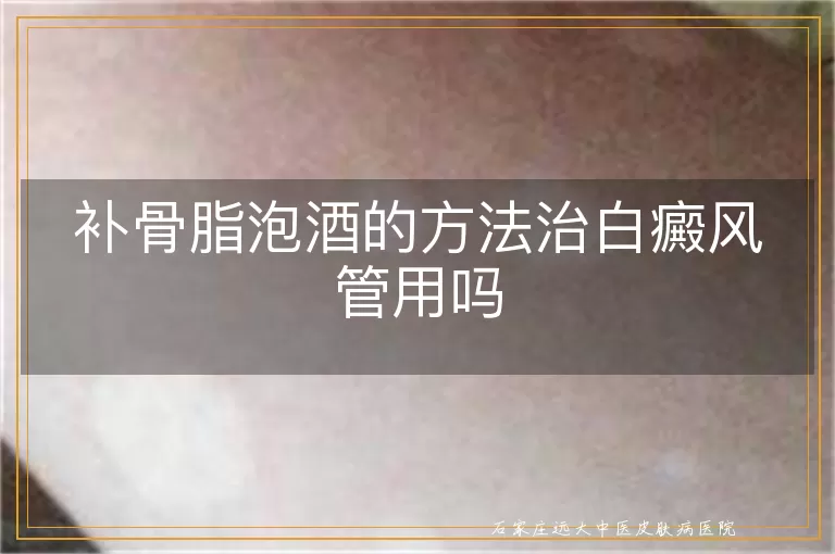 补骨脂泡酒的方法治白癜风管用吗