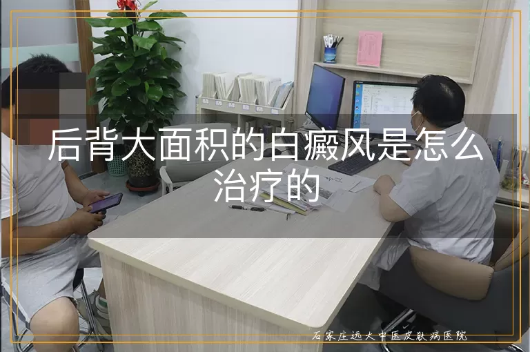 后背大面积的白癜风是怎么治疗的