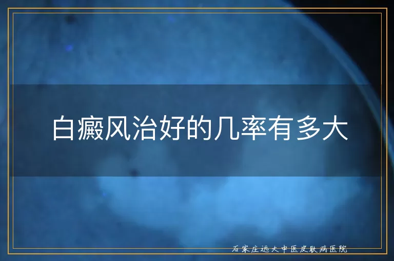 白癜风治好的几率有多大
