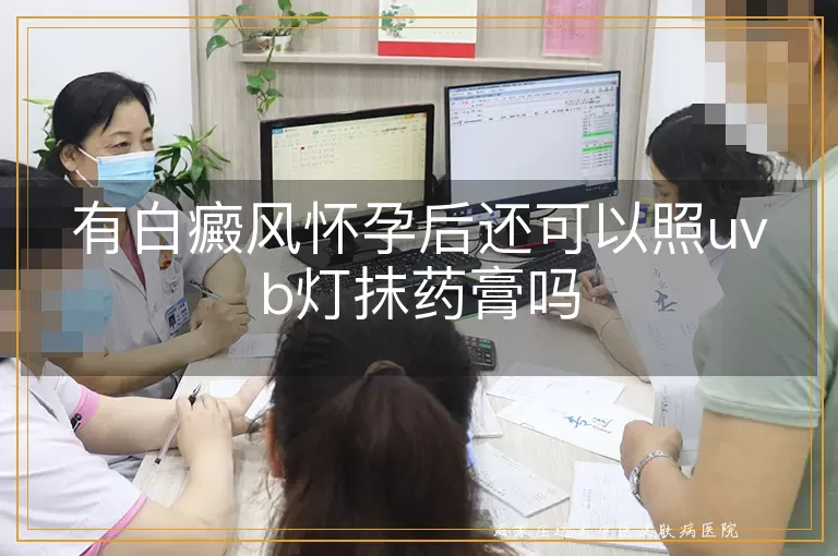 有白癜风怀孕后还可以照uvb灯抹药膏吗