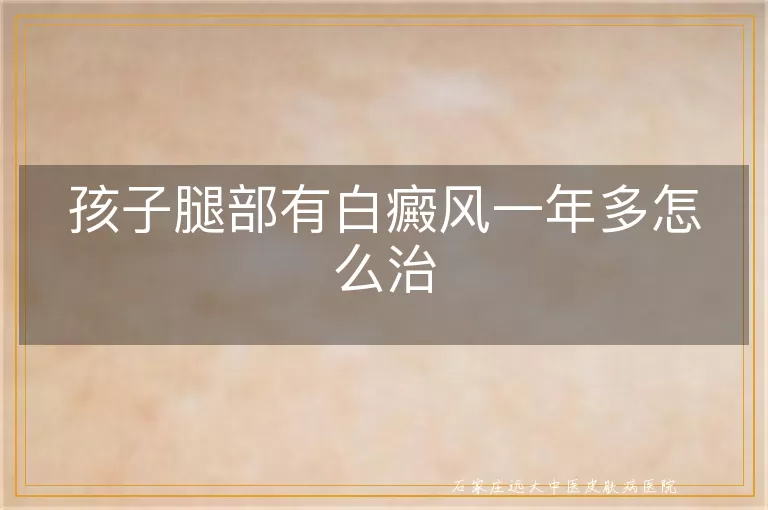 孩子腿部有白癜风一年多怎么治