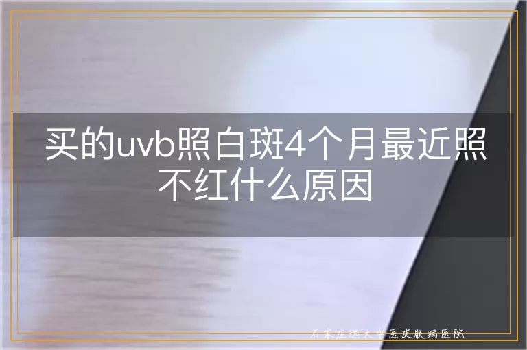 买的uvb照白斑4个月最近照不红什么原因