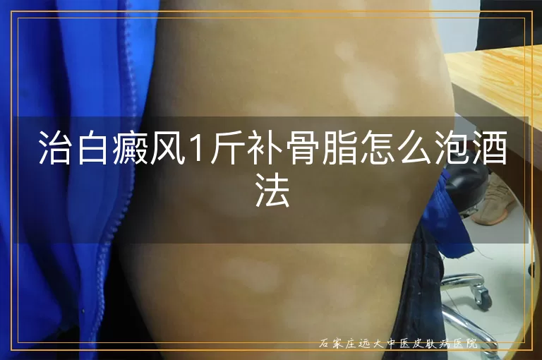 治白癜风1斤补骨脂怎么泡酒法