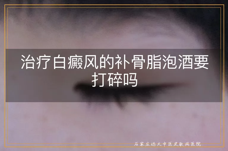 治疗白癜风的补骨脂泡酒要打碎吗