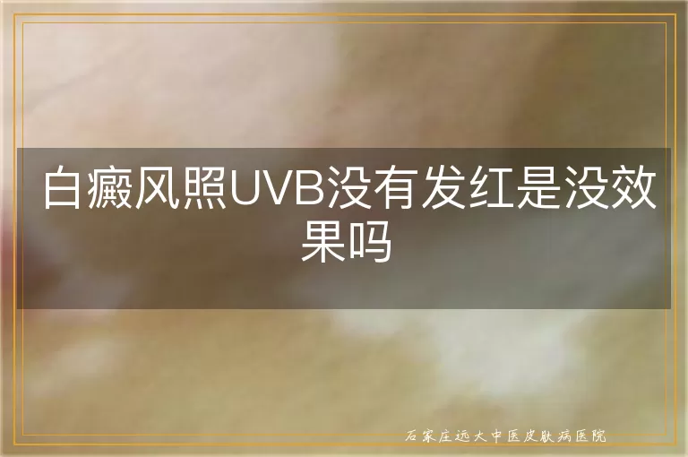 白癜风照UVB没有发红是没效果吗