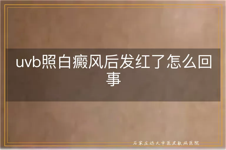 uvb照白癜风后发红了怎么回事