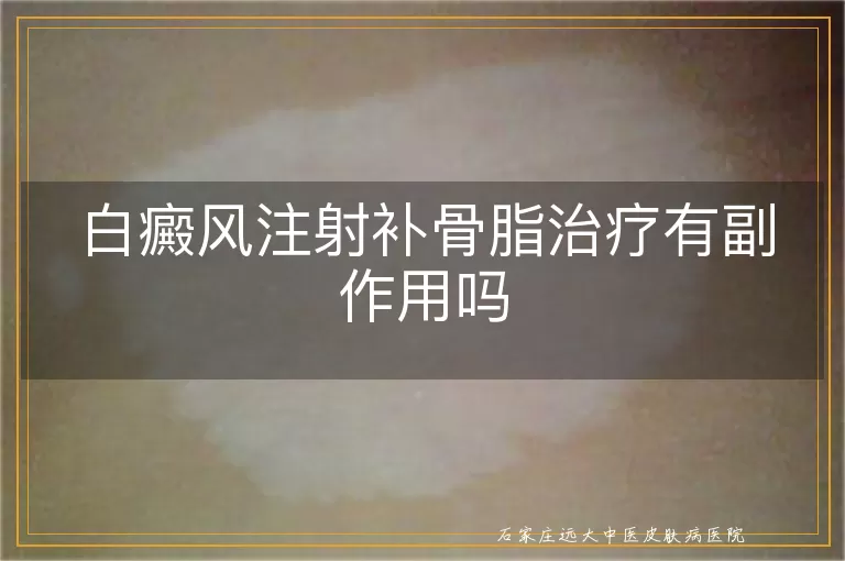 白癜风注射补骨脂治疗有副作用吗
