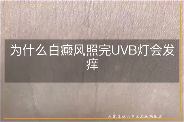 为什么白癜风照完UVB灯会发痒