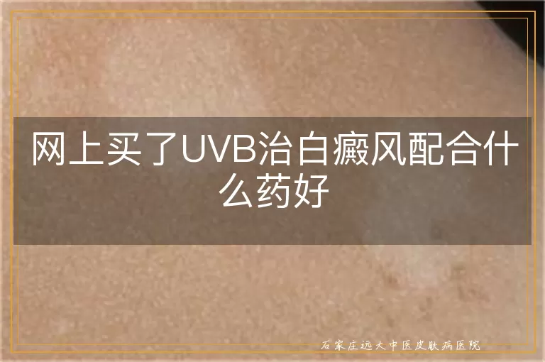 网上买了UVB治白癜风配合什么药好