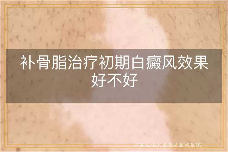 补骨脂治疗初期白癜风效果好不好