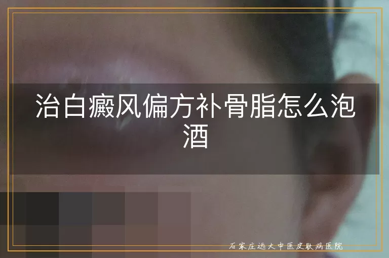 治白癜风偏方补骨脂怎么泡酒