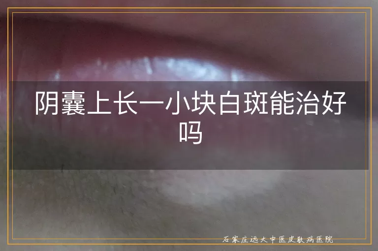 阴囊上长一小块白斑能治好吗
