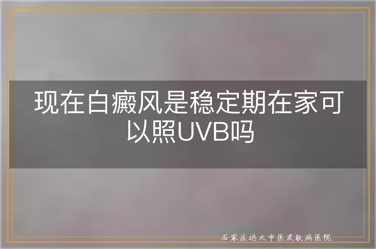 现在白癜风是稳定期在家可以照UVB吗