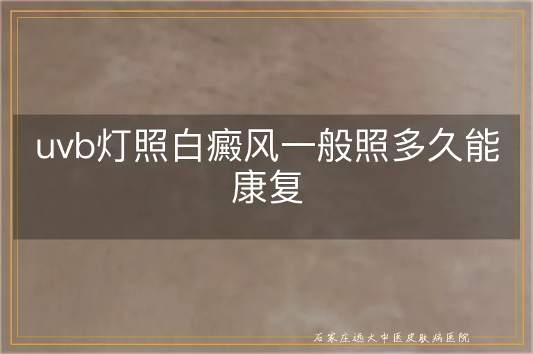 uvb灯照白癜风一般照多久能康复