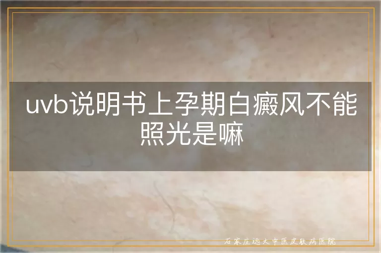 uvb说明书上孕期白癜风不能照光是嘛