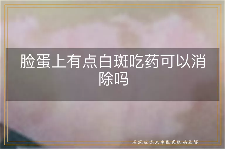 脸蛋上有点白斑吃药可以消除吗