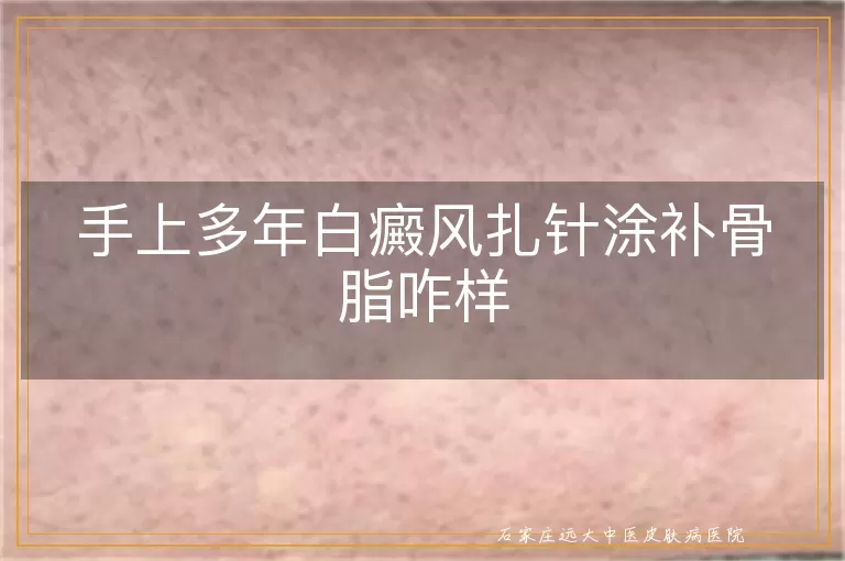 手上多年白癜风扎针涂补骨脂咋样