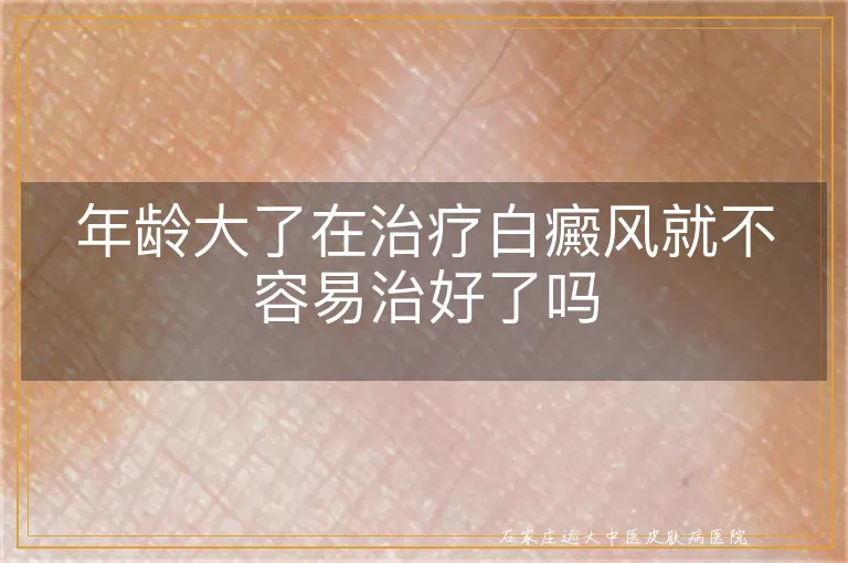 年龄大了在治疗白癜风就不容易治好了吗