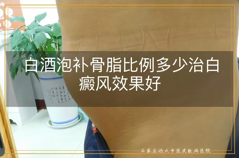 白酒泡补骨脂比例多少治白癜风效果好