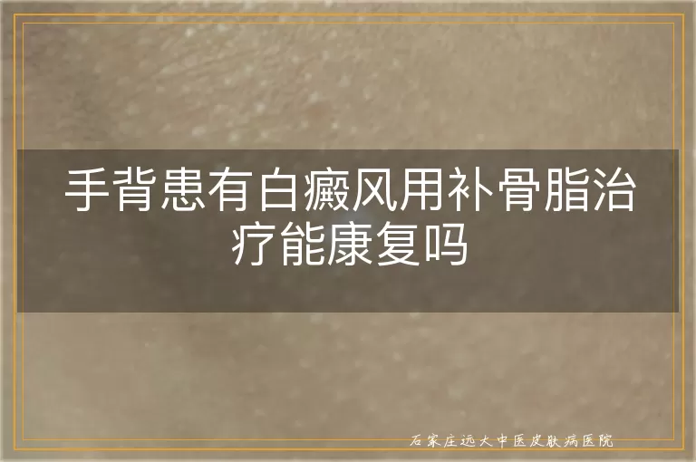 手背患有白癜风用补骨脂治疗能康复吗