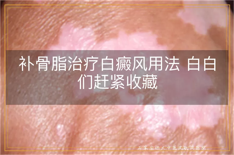 补骨脂治疗白癜风用法 白白们赶紧收藏