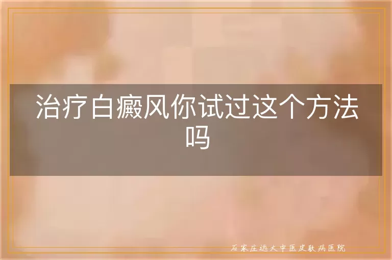 治疗白癜风你试过这个方法吗
