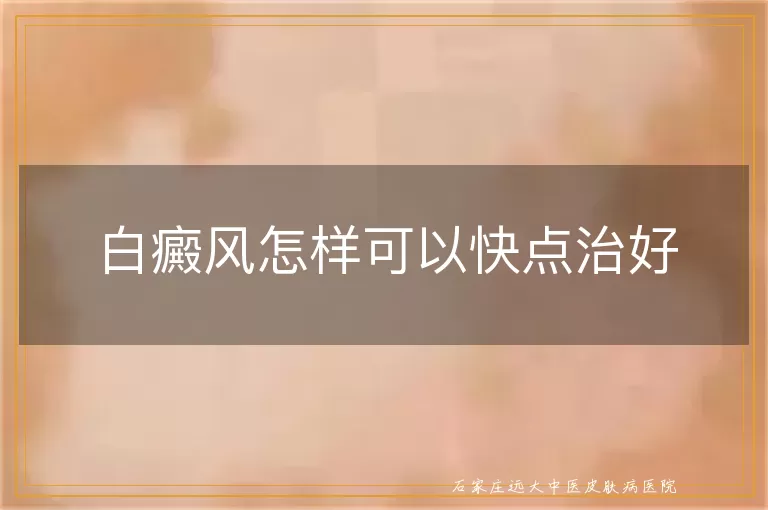 白癜风怎样可以快点治好
