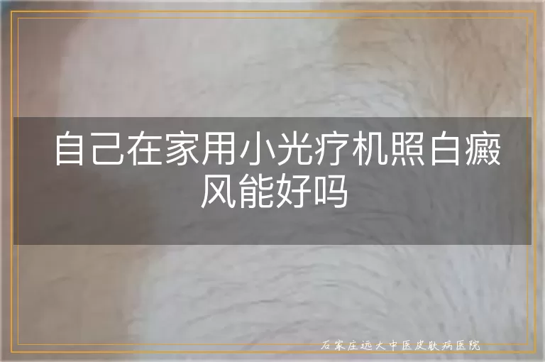 自己在家用小光疗机照白癜风能好吗