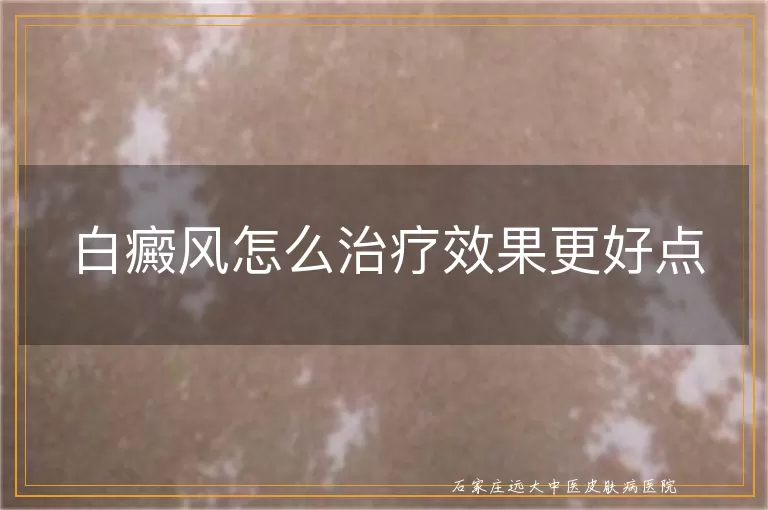 白癜风怎么治疗效果更好点