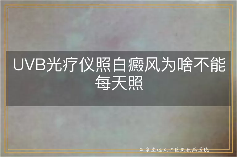 UVB光疗仪照白癜风为啥不能每天照