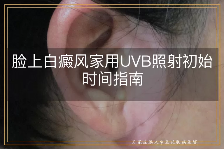 脸上白癜风家用UVB照射初始时间指南