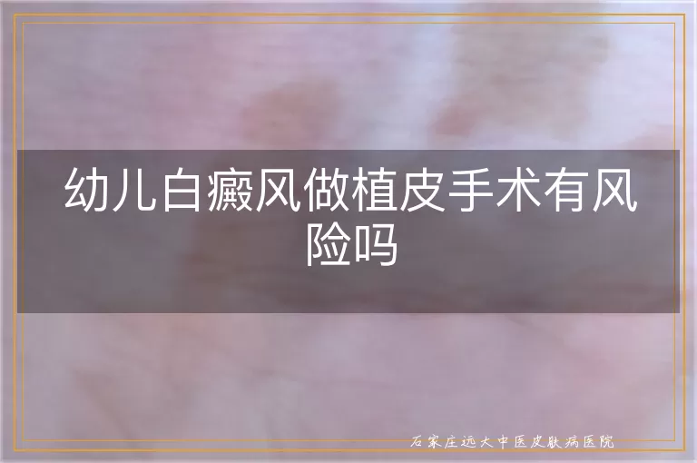 幼儿白癜风做植皮手术有风险吗