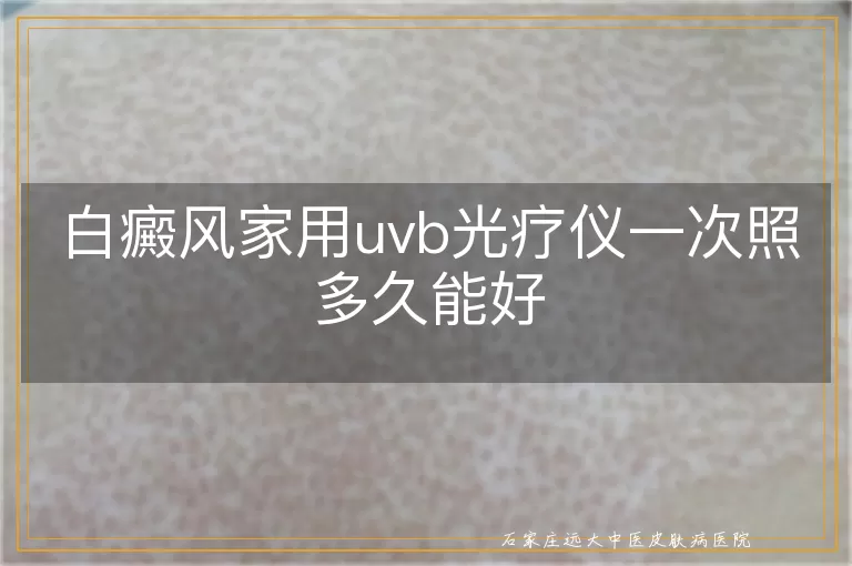 白癜风家用uvb光疗仪一次照多久能好