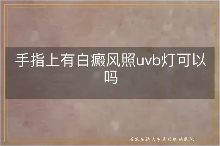 手指上有白癜风照uvb灯可以吗