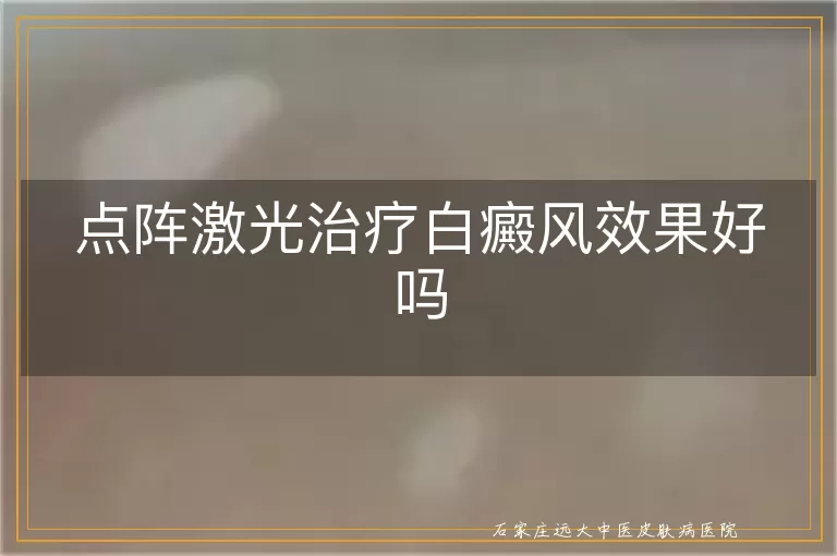 点阵激光治疗白癜风效果好吗
