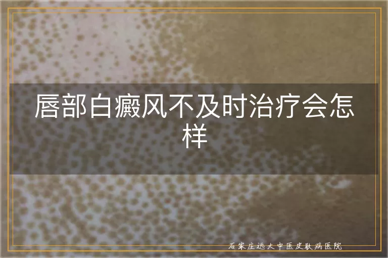 唇部白癜风不及时治疗会怎样