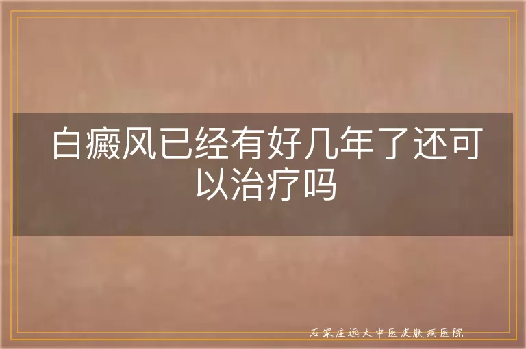白癜风已经有好几年了还可以治疗吗