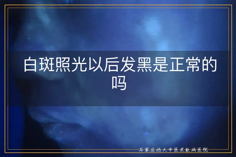 白斑照光以后发黑是正常的吗