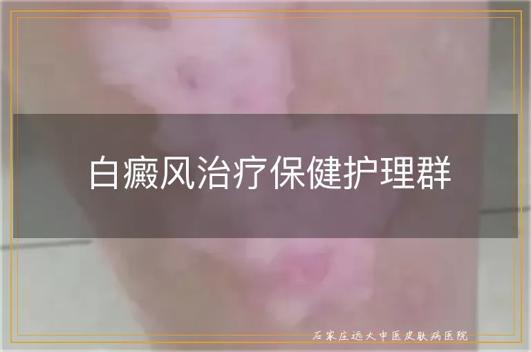 白癜风治疗保健护理群