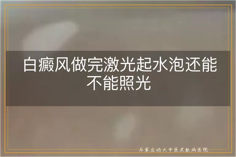 白癜风做完激光起水泡还能不能照光