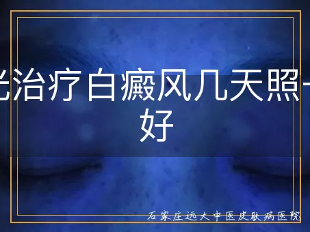 激光治疗白癜风几天照一次好