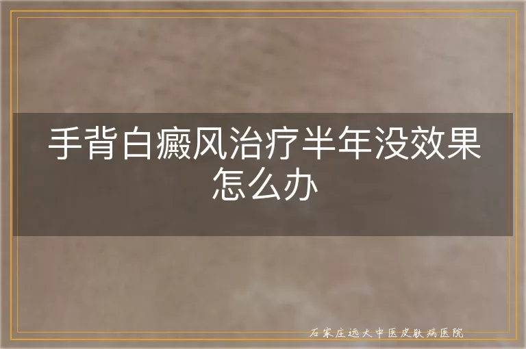 手背白癜风治疗半年没效果怎么办