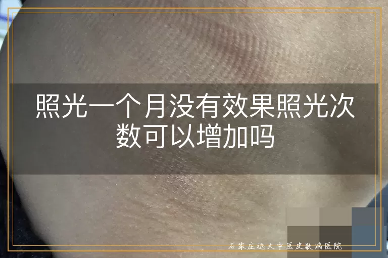 照光一个月没有效果照光次数可以增加吗